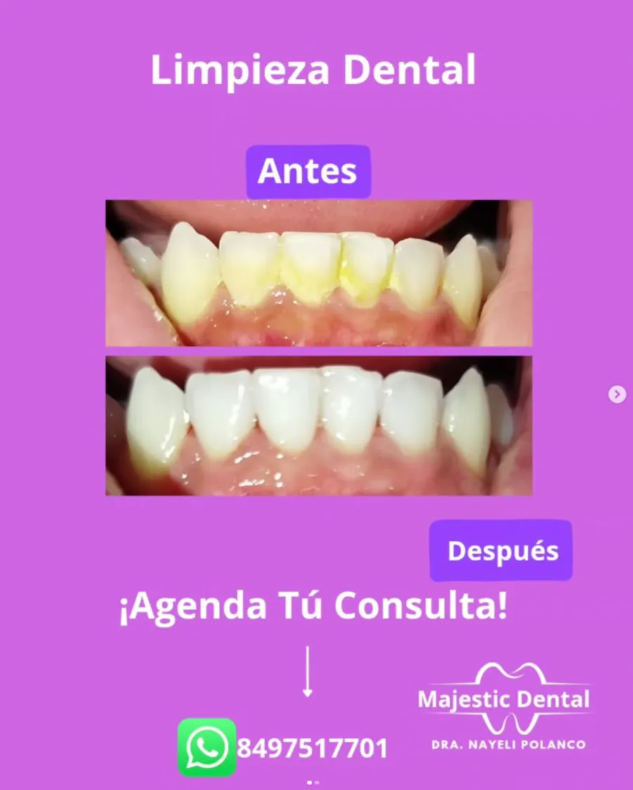 Promoción de limpieza dental de Majestic Dental